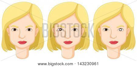 Eyes claucoma cataract in human illustration