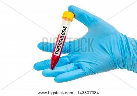 Test-tube With Blood Sample For Tuberculosis