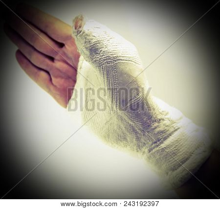 Injured Person With The Broken Limb After The Car Accident