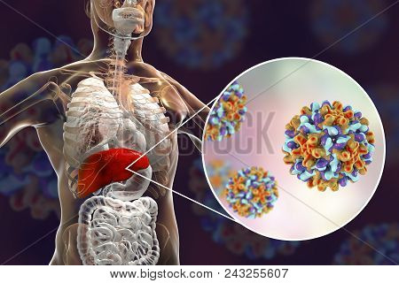 Liver With Hepatitis B Infection Highlighted Inside Human Body And Close-up View Of Hepatitis B Viru