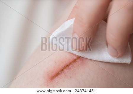First Aid For A Girl, Close Up