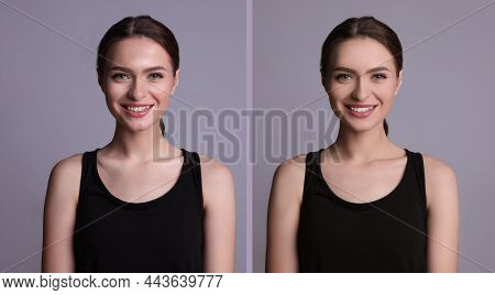 Collage With Photos Of Beautiful Young Woman Before And After Using Mattifying Wipes On Grey Backgro