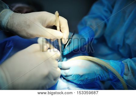 hand surgeon makes an operation closeup. surgical instruments