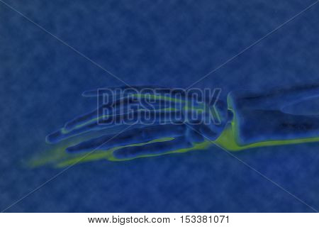 X-ray human skeleton bone fractured hand rontgen