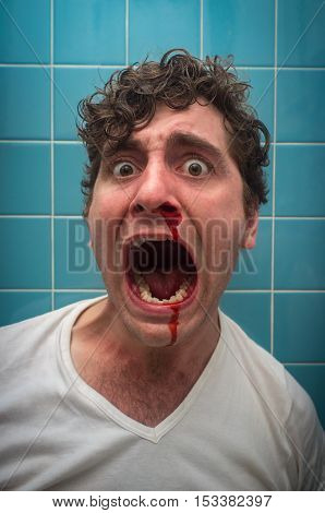 Curly haired man in bathroom with bad nose bleed