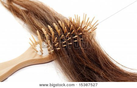 Hairloss