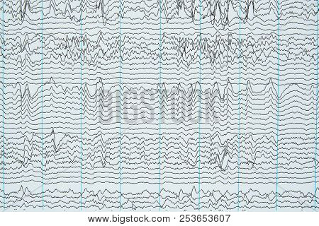Imaging Of Brain Waves From Electroencephalography Or Eeg In Human
