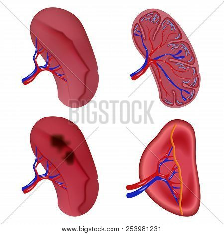 Spleen Milt Anatomy Icons Set. Realidtic Illustration Of 4 Spleen Milt Anatomy Icons For Web