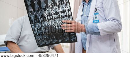 Doctor Show Film X-ray For A Patient At Hospital. Body Scan After Surgeryand Operate. Health And Wel