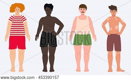 Boys In Swimsuites With Black Skin, Ginger Hair, Vitiligo, Plus Size Shapes Vector Illustration In F
