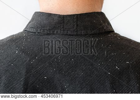 Close Up View Of Person's Shoulders In Black Shirt Covered With Dandruff. Copy Space. The Concept Of