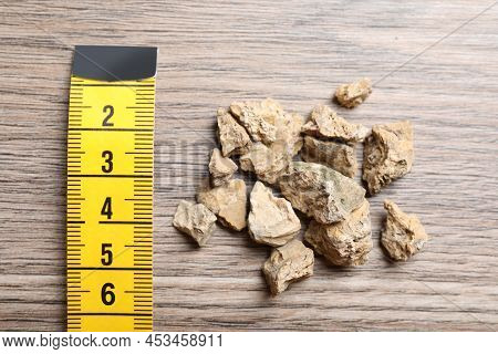 Pile Of Kidney Stones And Measuring Tape On Wooden Table, Flat Lay