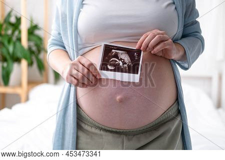 Top View Cropped Of Pregnant Woman With Ultrasound Photo Of Fetus Standing At Home, Young Future Mom