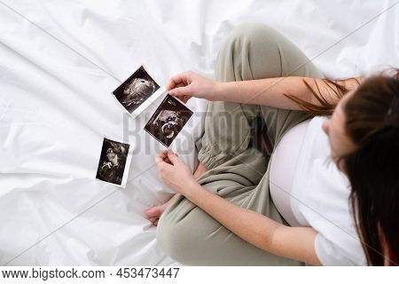 Top View Cropped Of Pregnant Woman Looking Ultrasound Photo Of Fetus Standing At Home, Young Future 