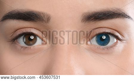 Woman With Different Colors Of Eyes, Closeup. Heterochromia Iridis