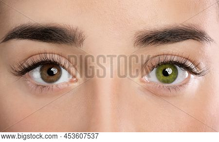Woman With Different Colors Of Eyes, Closeup. Heterochromia Iridis