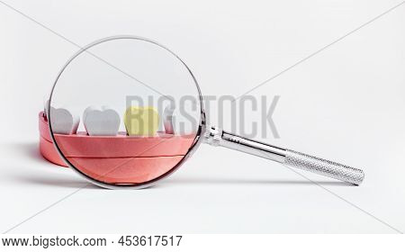 Magnifying Glass Over Sick Tooth With Plaque In Jaw Model. Teeth Checkup, Caries, Decay Treatment Co