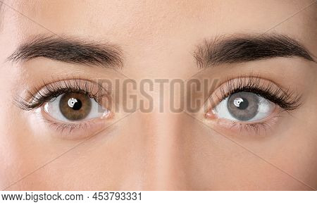 Woman With Different Colors Of Eyes, Closeup. Heterochromia Iridis