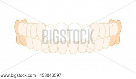 Teeth Row Denture Set Closeup Human Front Anterior Ventral View. Jaws Model With Teeth. Set Of Chump