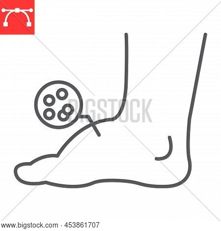 Leg Edema Line Icon, Diabetic And Foot, Leg Swelling Vector Icon, Vector Graphics, Editable Stroke O