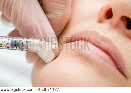 Close Up Of Hands Of Cosmetologist Making Botox Injection In Female Lips. Lip Shape Correction, Lip 