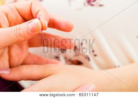Midwife setting pregnant woman acupuncture needle