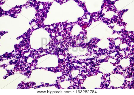 Microscopic photo showing lung tissue. Light micrograph of lung, magnification 100x