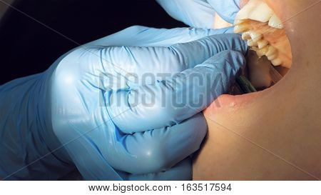 Woman at the dentist clinic office gets dental medical examination and treatment. Close up shot. Odontic and mouth health is important part of modern human life that dentistry help with.