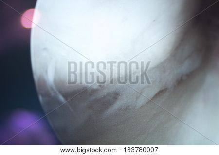 Arthroscopy Surgery Screen