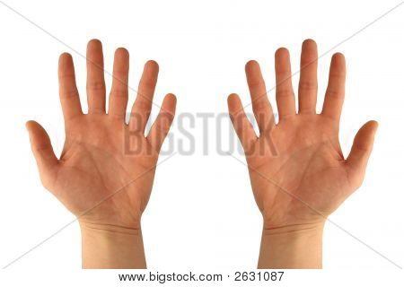 Mani con sei dita