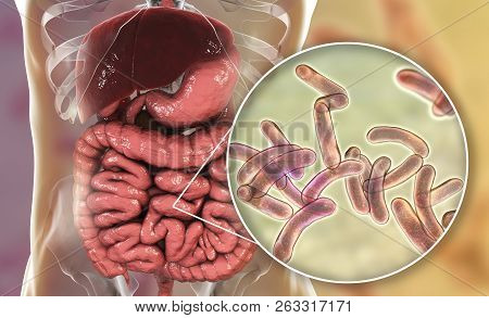 Vibrio Cholerae Bacteria In Small Intestine, 3d Illustration. Bacterium Which Causes Cholera Disease