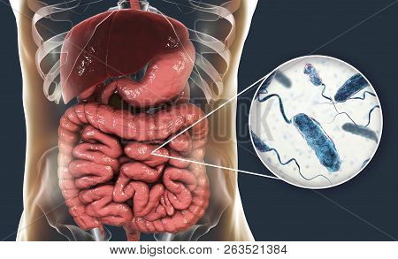 Vibrio Cholerae Bacteria In Small Intestine, 3d Illustration. Bacterium Which Causes Cholera Disease