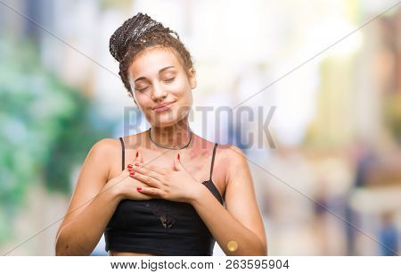 Young braided hair african american with pigmentation blemish birth mark over isolated background smiling with hands on chest with closed eyes and grateful gesture on face. Health concept.
