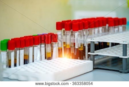 Rack Of Blood Tubes Test For Analysis In The Laboratory Of Hematology. Blood Laboratory. Illness Tes