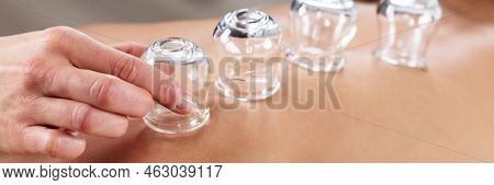 Cupping Therapy Using Vacuum Chinese Glass. Cup Massage