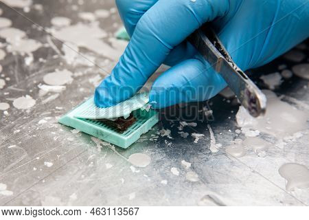 Cassette Containing A Biopsy Sample. Scientist Embedding Tissues In Paraffin Blocks For Sectioning. 