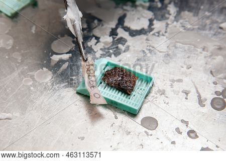Label Used To Identify The Biopsy Sample. Scientist Embedding Tissues In Paraffin Blocks For Section