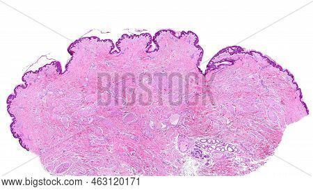 Low Power Light Microscope Micrograph Of A Human Breast Nipple. It Is Covered By A Pigmented Thin Sk