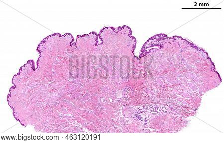 Low Power Light Microscope Micrograph Of A Human Breast Nipple. It Is Covered By A Pigmented Thin Sk