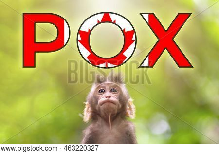 A New Outbreak Of Viral Infection In Canada, Monkey Pox. Little Monkey Look At Text Pox With Canadia
