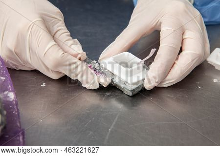 Scientist Preparing Paraffin Blocks Containing Biopsy Tissue For Sectioning. Pathology Laboratory. C