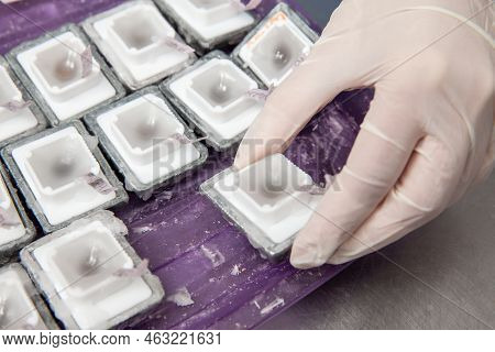 Scientist Preparing Paraffin Blocks Containing Biopsy Tissue For Sectioning. Pathology Laboratory. C