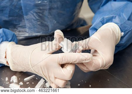 Scientist Preparing Paraffin Blocks Containing Biopsy Tissue For Sectioning. Pathology Laboratory. C