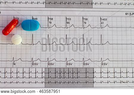 Electrocardiogram Showing A Supraventricular Tachycardia And Colored Pills. Medical Desk Concept Or 