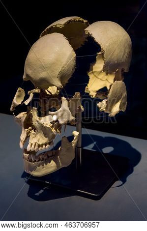 Moscow, Russia - May 05, 2021: Famous Anatomy Exhibition Body Worlds Where Plastinated Bodies Are Ex