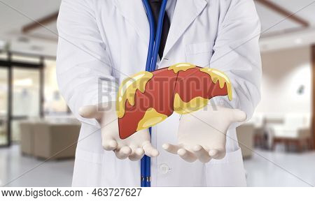 Doctor Touch Fatty On Liver , Concept Fatty Liver In Hospital