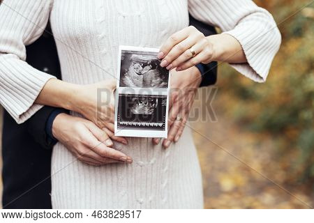 Happy Couple With Pregnancy News Holding Ultrasound Baby Scan. Pregnant Woman And Her Husband Expect
