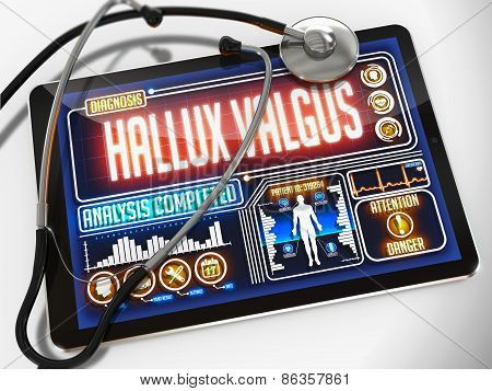 Hallux Valgus on the Display of Medical Tablet.