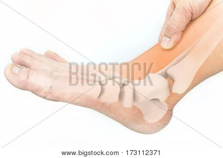 foot bones pain white background , foot injury