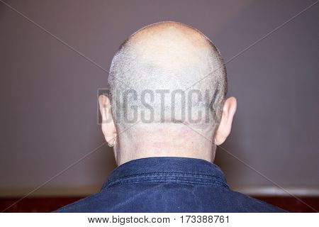Back of man with bald head and earring in ear